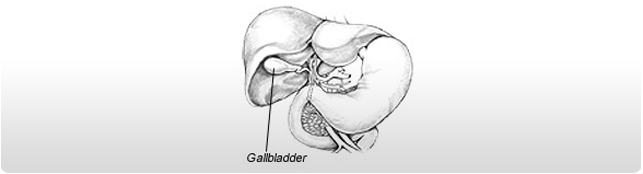 Gallbladder Cancer