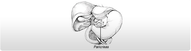 Pancreatic Cancer