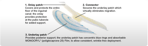 Ultrapro Mesh